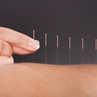 Prøv akupunktur mod din skavank